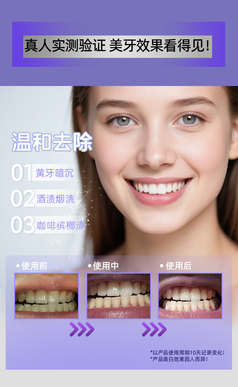 新美白牙套带证书彩页_07.jpg